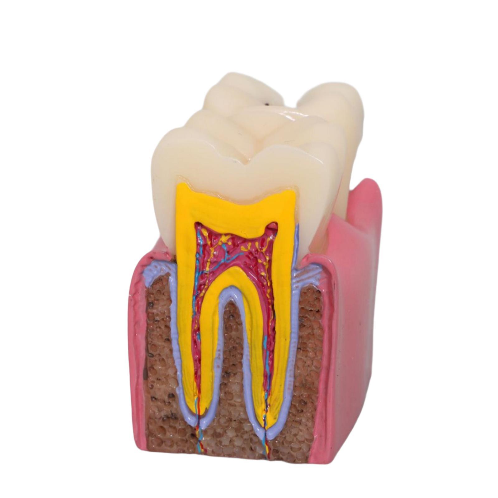 Tooth Decay Model Roots Canal  - Kids Education Classes บทวิจารณ์และราคา